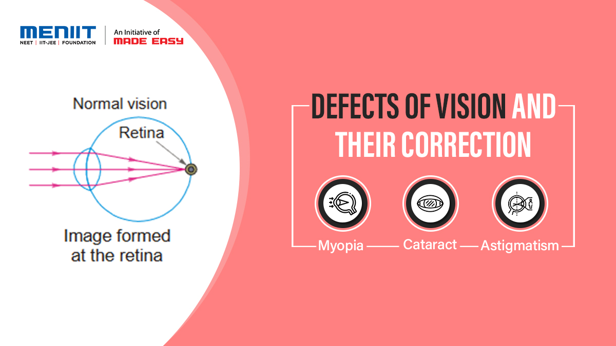 Defects Of Vision And Their Correction Physics CLASS X MENIIT