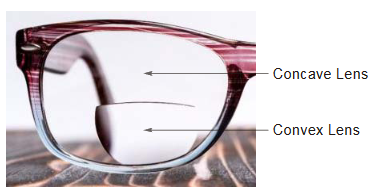 Presbyopia