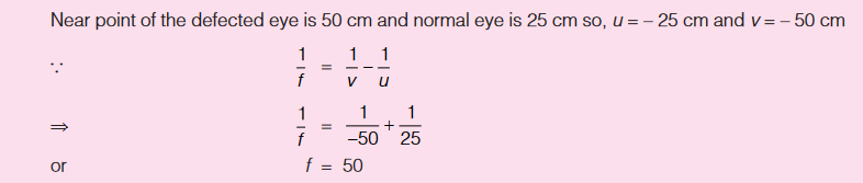 Astigmatism