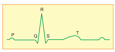 electrocardiogram