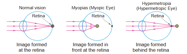 retina 